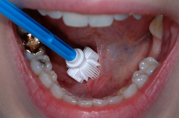 Floor of the mouth